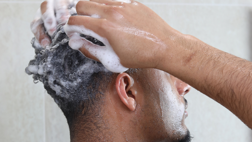 Conquer Dandruff Naturally: Ditch the Harsh Chemical based shampoos